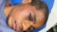 Amnesty Internasional: Penyiksaan Anak di Keerom, Bukti  Negara Gagal Lindungi HAM di Papua